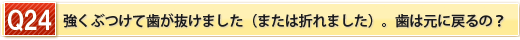 強くぶつけて歯が抜けました（または折れました）。歯は元に戻るの？？