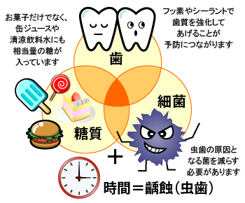 虫歯の原因